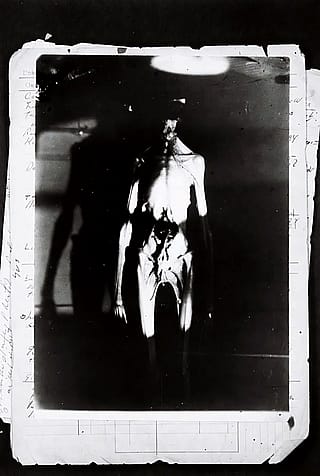 AI reimagined from old medical archives into something unsettling and otherworldly.'