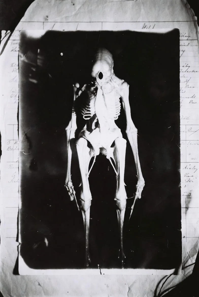 AI reimagined from old medical archives into something unsettling and otherworldly. picture 12 of 17