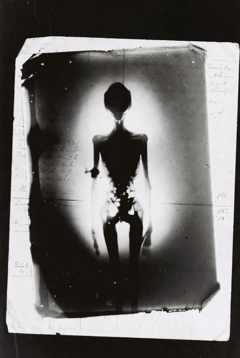 AI reimagined from old medical archives into something unsettling and otherworldly. picture 16 of 17