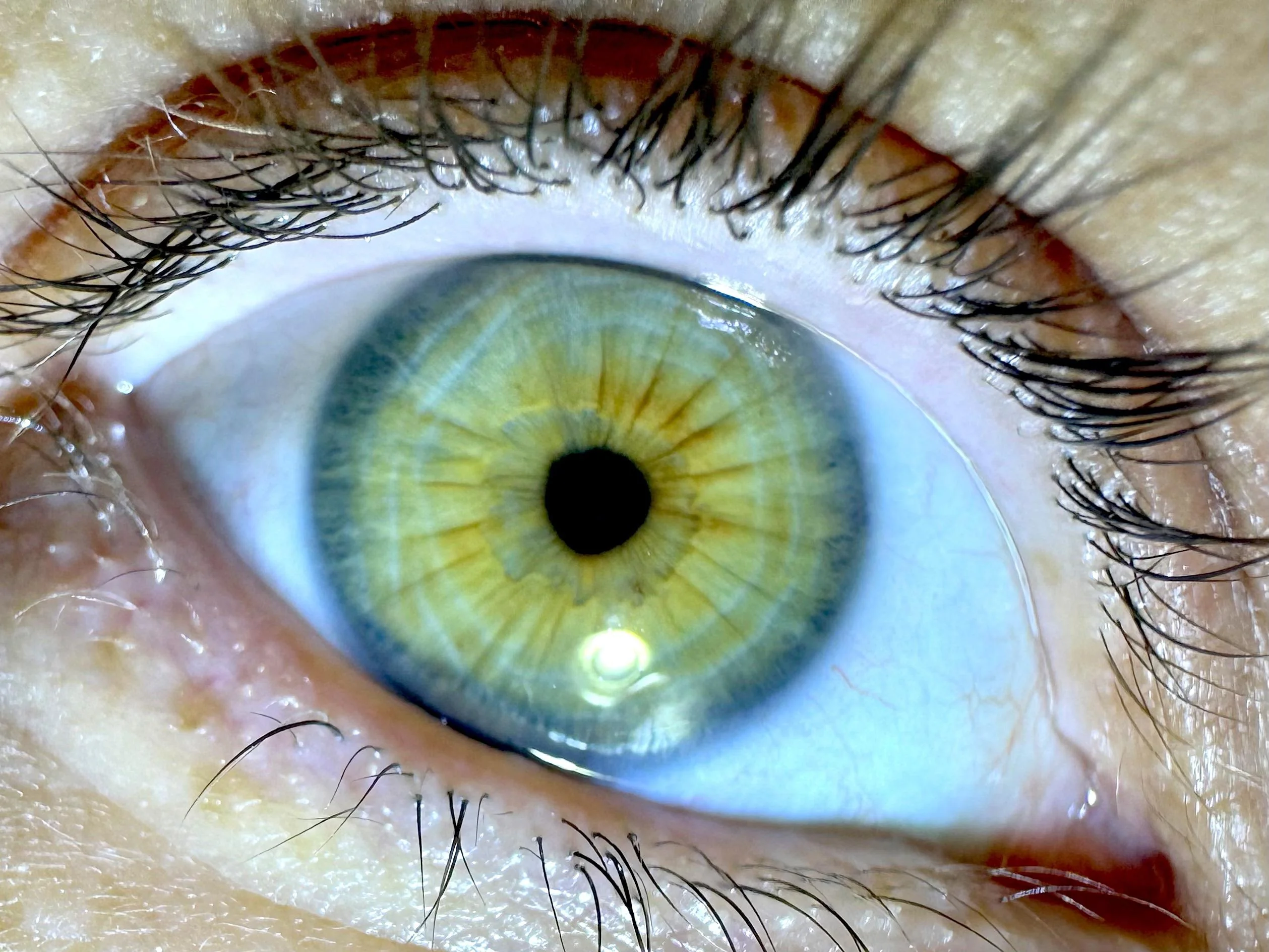 My eye in Ultraviolet picture 1 of 2