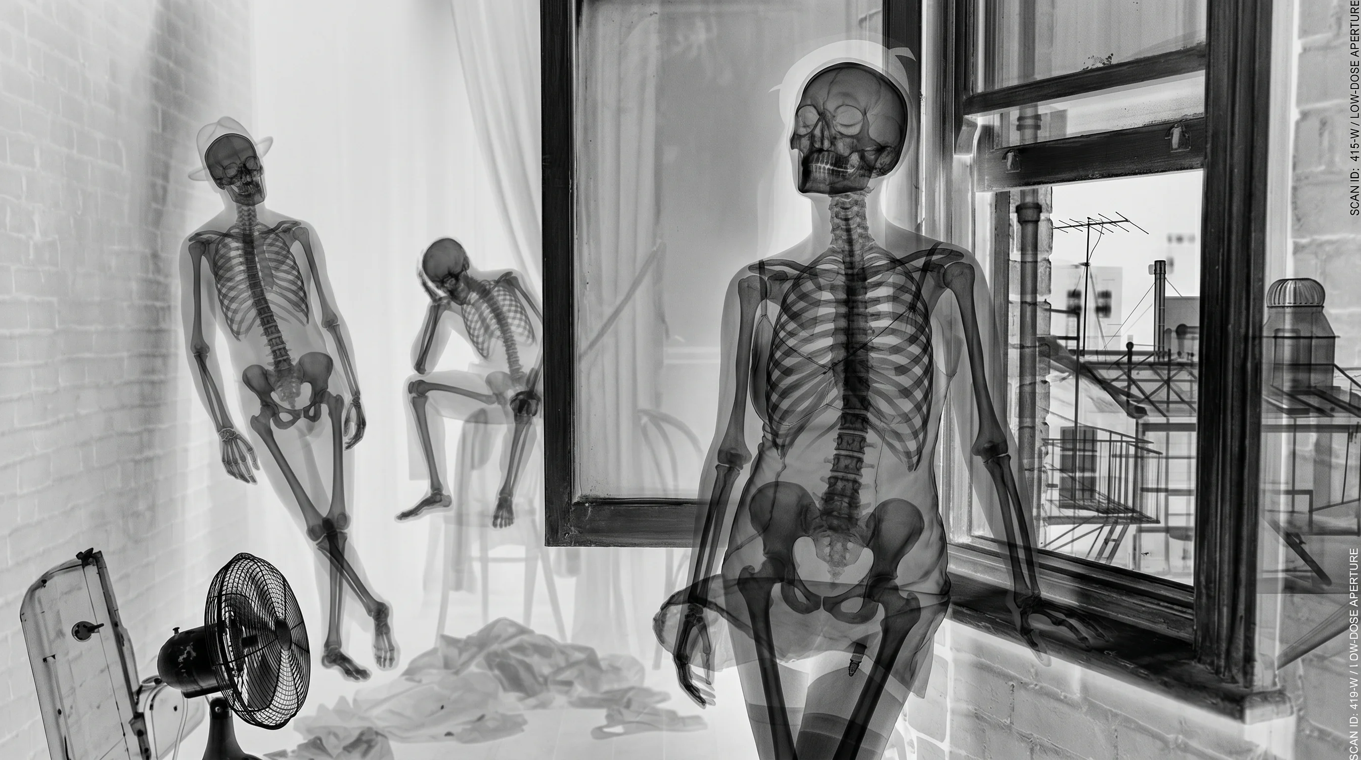 X-Rays picture 1 of 2